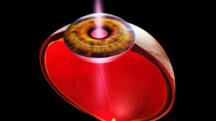 m04_007 Auge in der Perspektivansicht mit Hornhaut, Iris und Linsenkrper