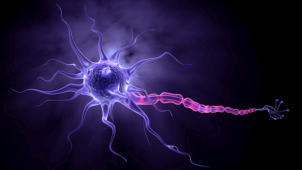 m20_005 Nervenzelle (Neuron) u.a. zur Steuerung der Sehimpulse