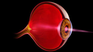 m04_025 Auge im seitlichen Lngsschnitt (Aufbau) mit Glaskrper und feinsten Blutgefen