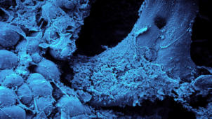 m01_015 Spongiosa-Blkchen mit Fettzellen (REM-Aufnahme)