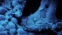 m01-015 Spongiosa-Blkchen mit Fettzellen (REM-Aufnahme)